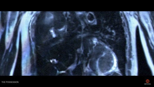 artifex_Possession_MRI_finalVFX